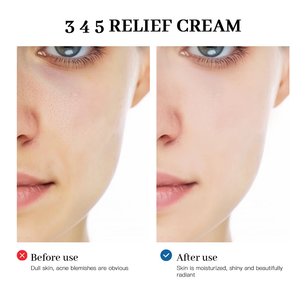 345 Relief Cream Comprehensive solution to skin problems Anti-sugar and antioxidant Brightening skin Improving acne marks